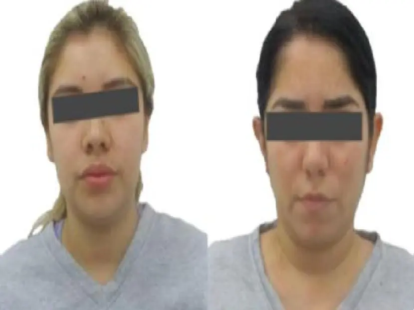 Mujeres fueron detenidas tras robo a su cita de Tinder